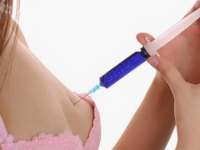 Hyaluronsäure-Injektionen zur Brustvergrößerung